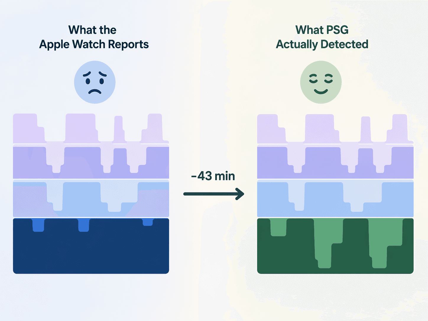 A comparison showing Apple Watch reporting less deep sleep than PSG, with a minus 43 minute annotation