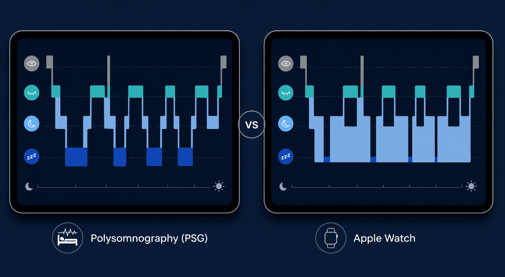 Side-by-side comparison of two sleep stage hypnograms for the same night. Left side labeled 'Polysomnography (PSG)' shows balanced deep, light, REM, and wake stages. Right side labeled 'Apple Watch' shows less deep sleep and more light sleep.