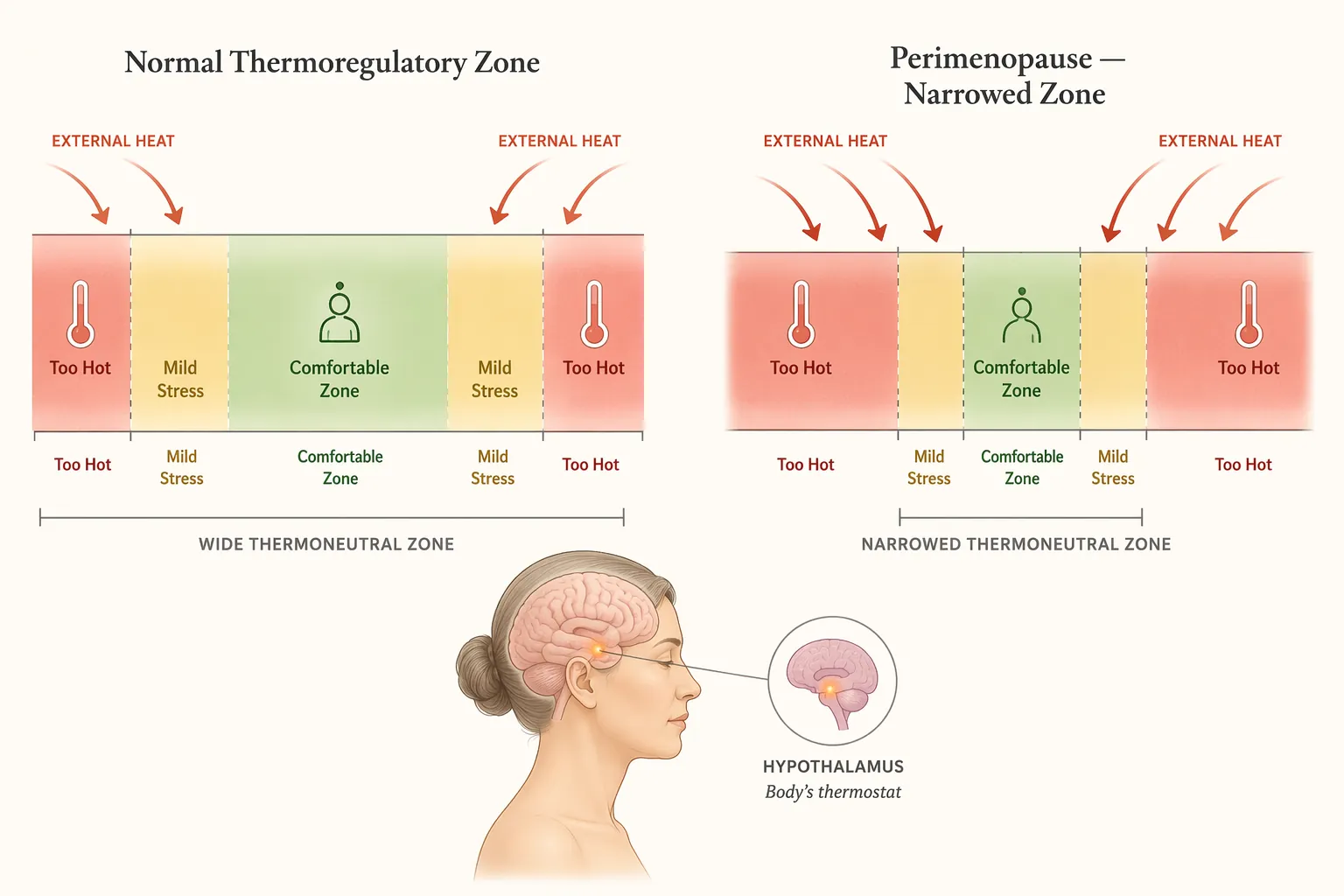 Diagram comparing a wide thermoregulatory zone with a narrowed perimenopause thermoregulatory zone