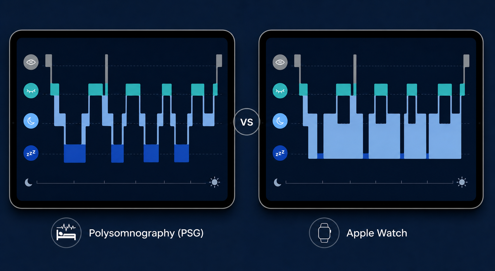 Side-by-side comparison of two sleep stage hypnograms for the same night. Left side labeled 'Polysomnography (PSG)' shows balanced deep, light, REM, and wake stages. Right side labeled 'Apple Watch' shows less deep sleep and more light sleep.