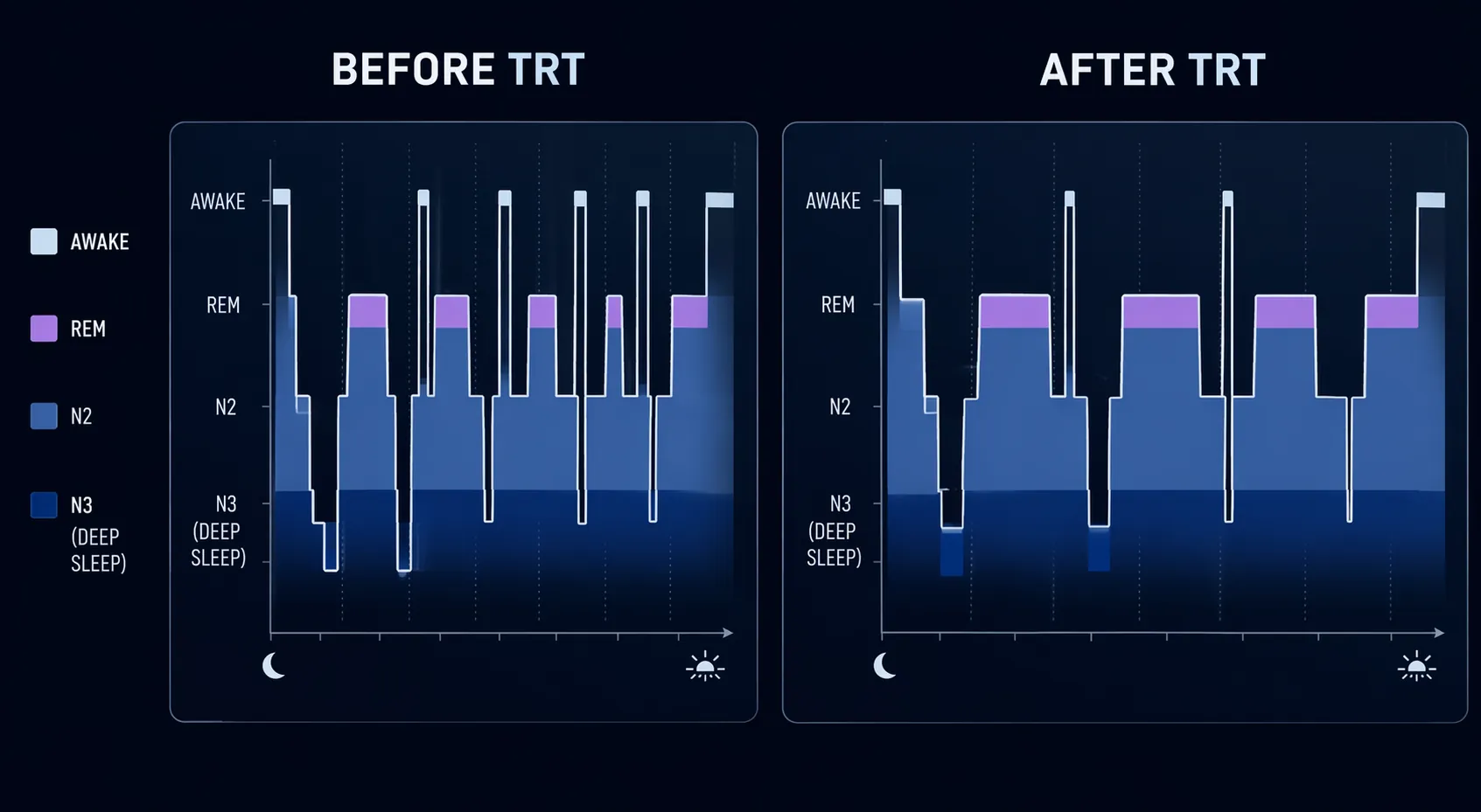 Side-by-side sleep architecture comparison showing more deep sleep and REM after testosterone therapy
