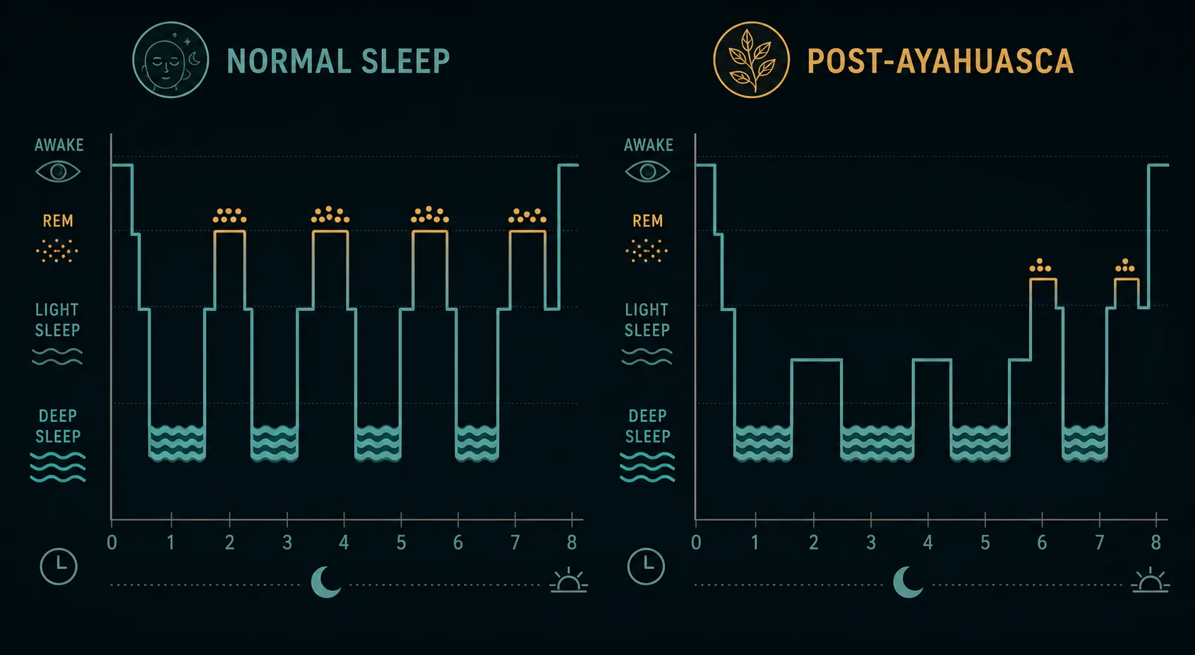 Side-by-side sleep hypnograms comparing normal sleep cycles with delayed and shortened REM periods after ayahuasca