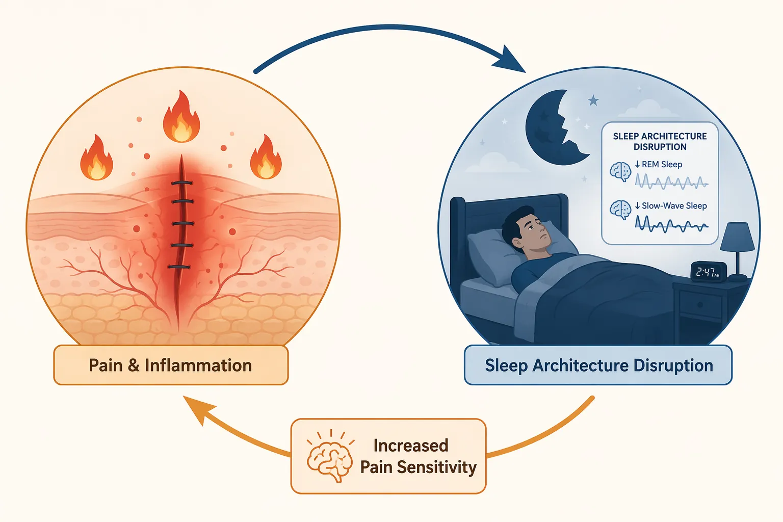 Infographic of surgical pain and inflammation disrupting sleep, with poor sleep increasing pain sensitivity