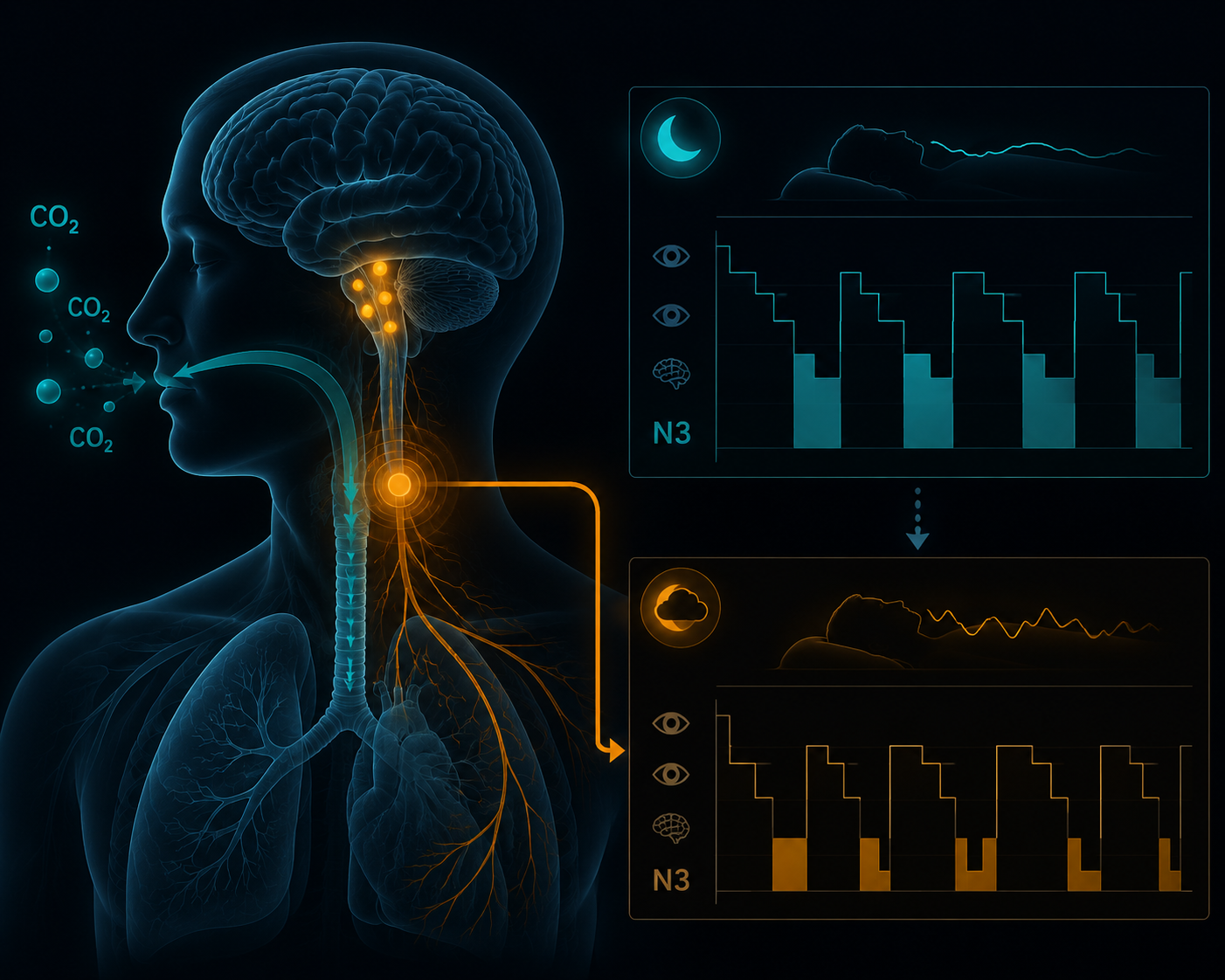 Illustration of chemoreceptor activation and reduced deep sleep under high carbon dioxide